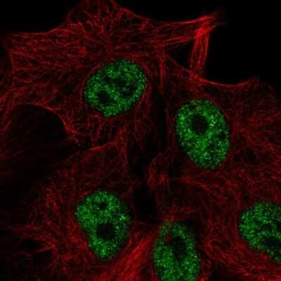 Immunocytochemistry/ Immunofluorescence: solute carrier family 22, member 18 antisense Antibody [NBP2-39093]