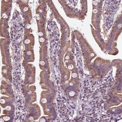 Immunohistochemistry-Paraffin: solute carrier family 22, member 18 antisense Antibody [NBP2-39093]
