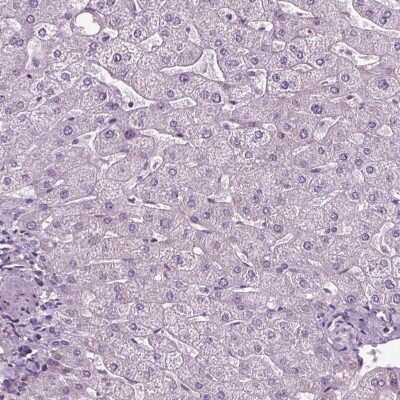 Immunohistochemistry-Paraffin: solute carrier family 22, member 18 antisense Antibody [NBP2-39093]