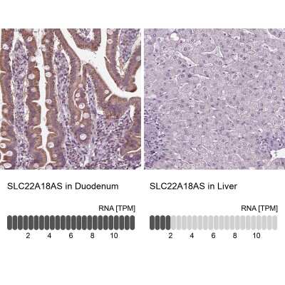 Immunohistochemistry-Paraffin: solute carrier family 22, member 18 antisense Antibody [NBP2-39093]