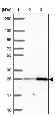 Western Blot: solute carrier family 22, member 18 antisense Antibody [NBP2-39093]