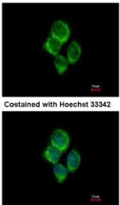 Immunocytochemistry/ Immunofluorescence: solute carrier family 22, member 18 antisense Antibody [NBP2-15120]