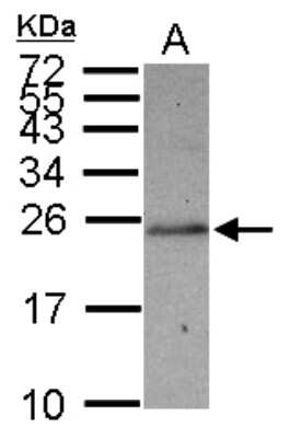 Western Blot: solute carrier family 22, member 18 antisense Antibody [NBP2-15120]