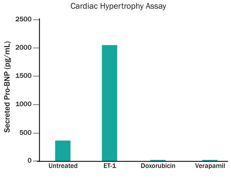 doxorubicin decreases Pro-BNP secretion from cardiomyocytes