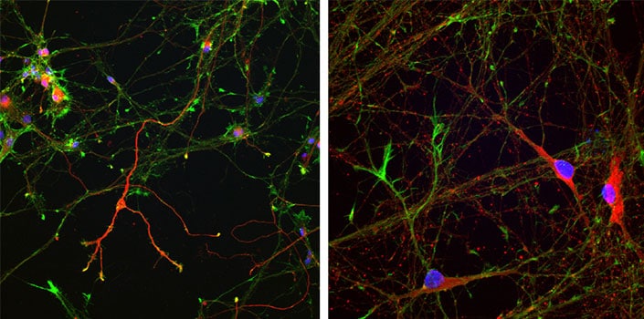 Using DAPT to differentiate hiPSCs into dopaminergic neurons