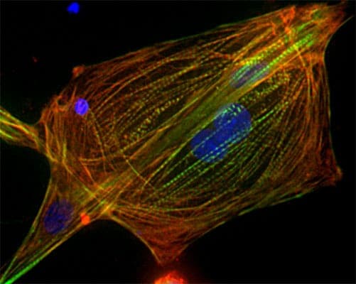 Cardiomyocyte derived from human induced pluripotent stem cells (hiPSCs) using CHIR 99021.