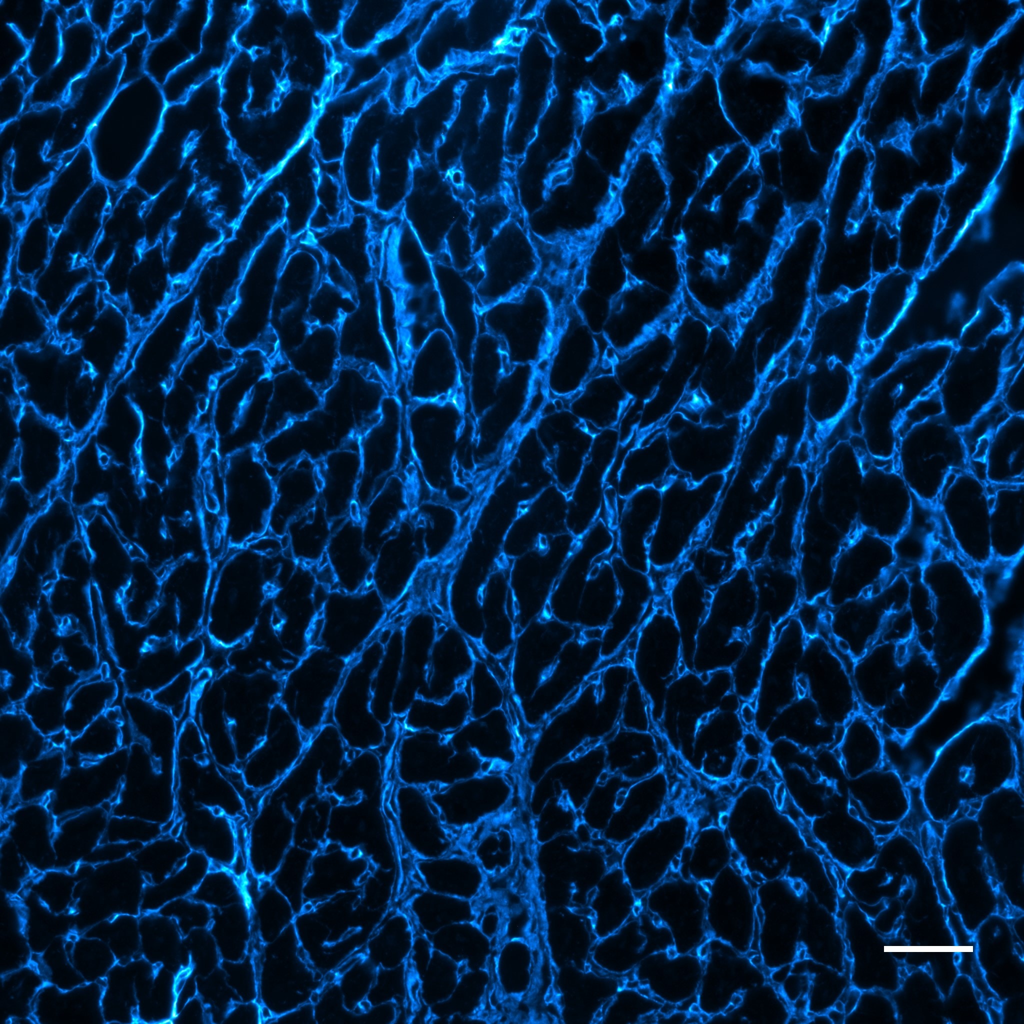 Application of Janelia Fluor® Dyes in Cardiac Tissue