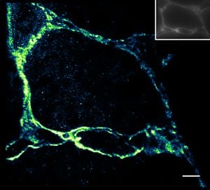 Application of Janelia Fluor® 646, NHS ester in Cardiac Tissue.