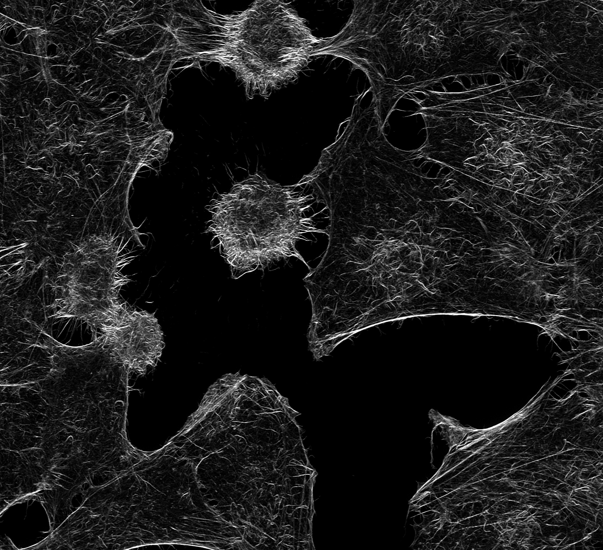Application of Phalloidin-Janelia Fluor® 646