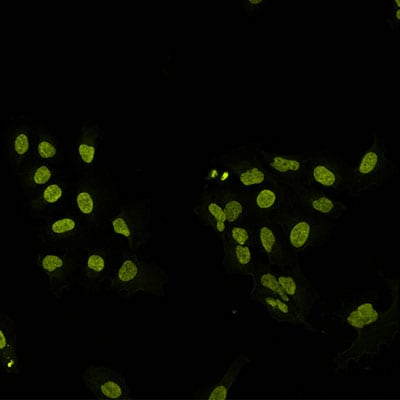 Application of Hoechst Janelia Fluor® 526 in U2OS cells.