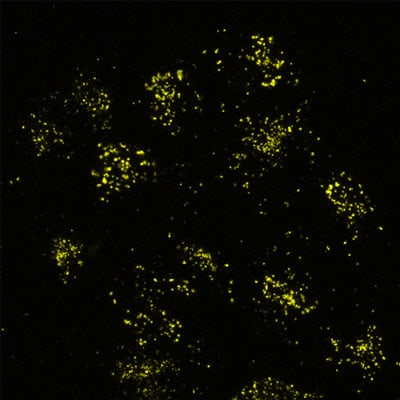 Application of Pepstatin A Janelia Fluor® 526 in live U2OS cells.