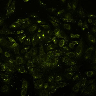 Application of Pepstatin A Janelia Fluor® 526 in fixed U2OS cells.