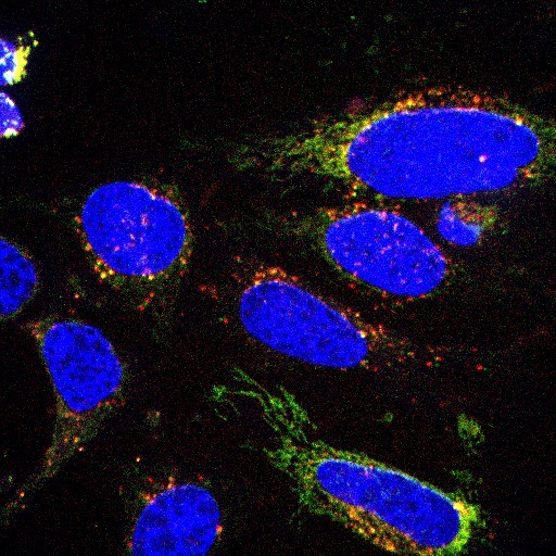 Application of SCOTfluor glucose probe 510 in HeLa cells
