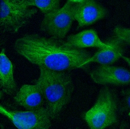 Application of NIR Dye s775z, NHS in HT-1080 human fibrosarcoma.