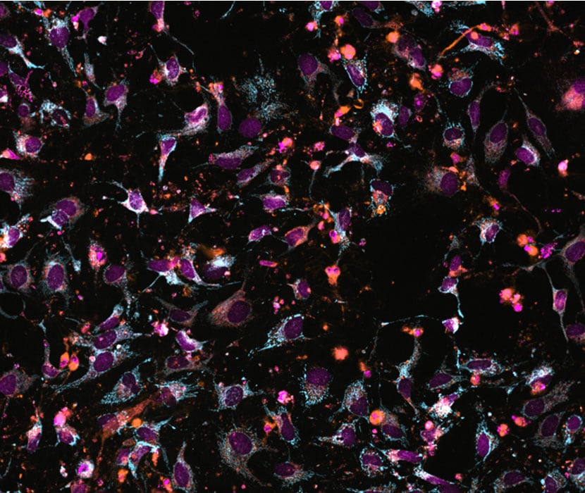 Ready-to-use fluorescent probe for long term high content phenotypic screening of live cells