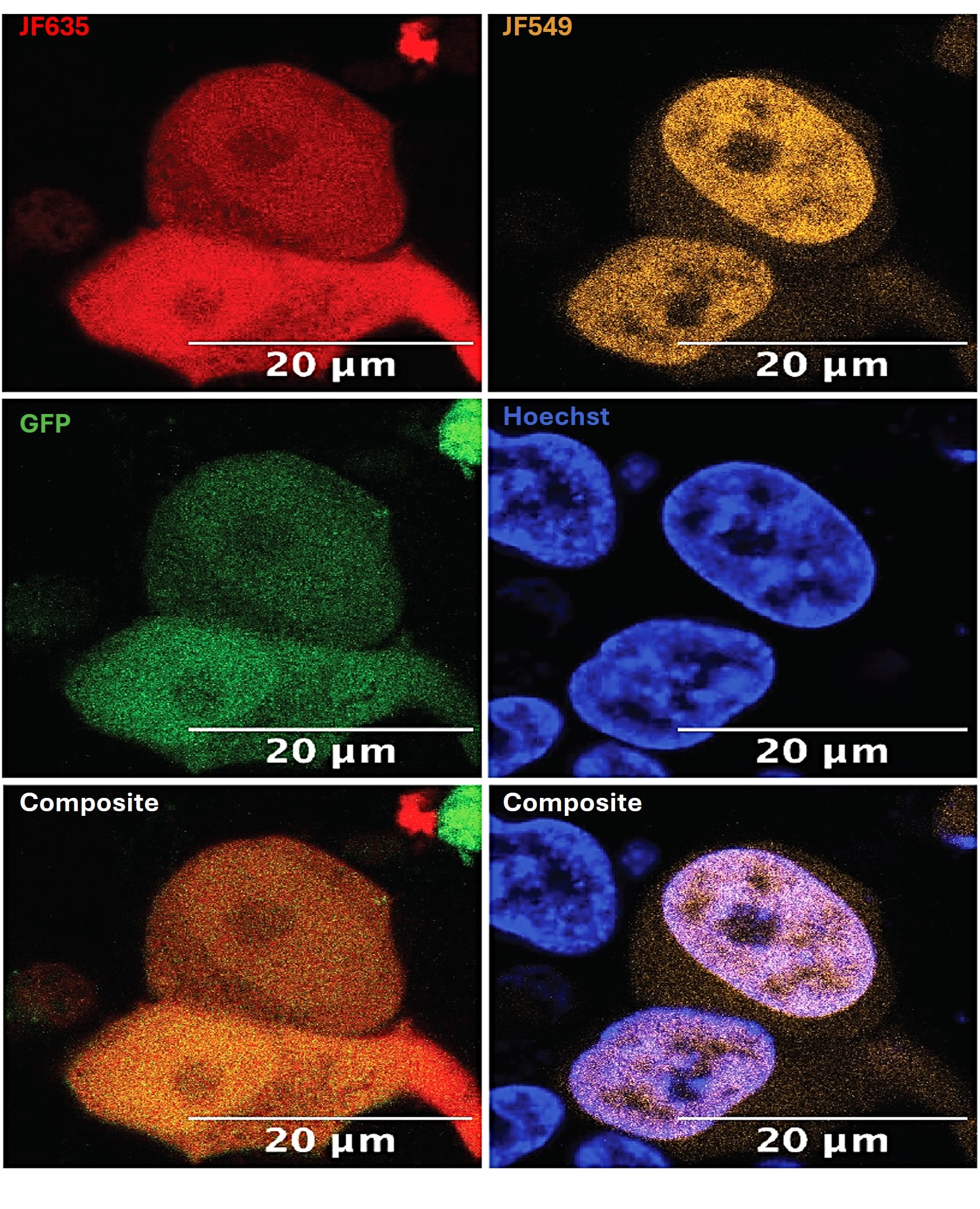Multiplexed fluorescence imaging of HEK293 cells expressing GFP-BromoCatch™ and H2B-HaloTag®.