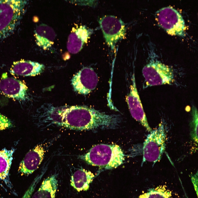 Multiplexed Phenotypic Imaging with ChromaLIVE™ Deep Red and ER-LIVE™ Endoplasmic Reticulum Dye