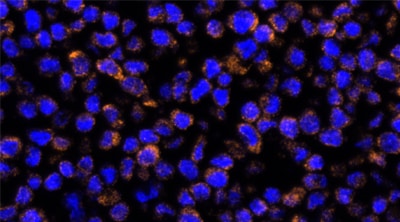 ClariTSA™ Fluorophore Kit 620 image