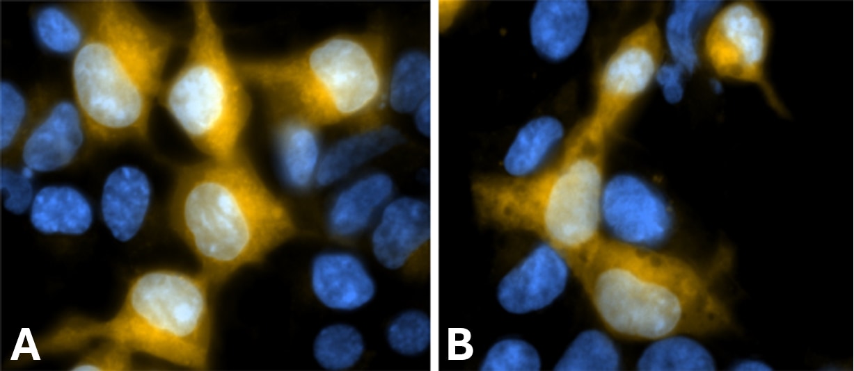 SPiDER-beta Gal labels  beta -galactosidase-expressing cells in both live and fixed conditions