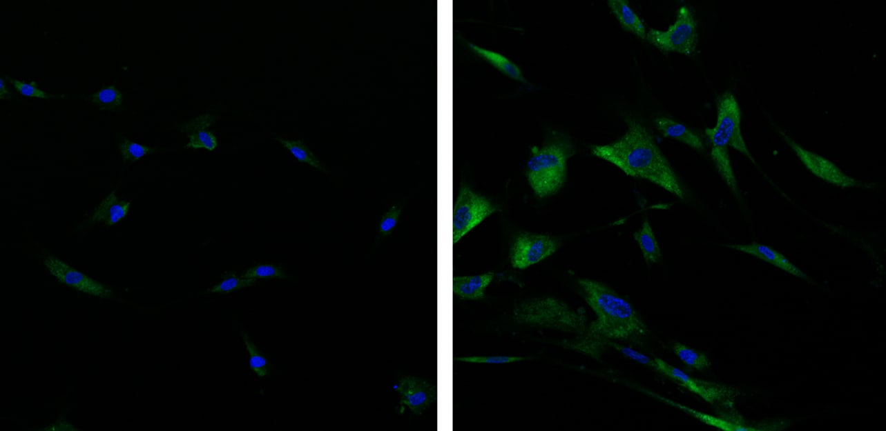 Detection of senescence-associated  beta -galactosidase (SA-beta -gal) activity using SPiDER-beta Gal
