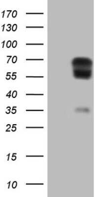 Western Blot: t-Plasminogen Activator/tPA Antibody (OTI3H3) [NBP2-46435]
