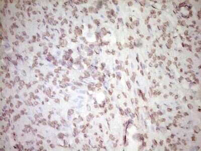 Immunohistochemistry: t-Plasminogen Activator/tPA Antibody (OTI3H3) - Azide and BSA Free [NBP2-74568]