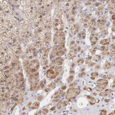 Immunohistochemistry: taxilin gamma Antibody [NBP1-90606]