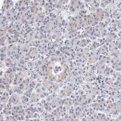 Immunohistochemistry-Paraffin: taxilin gamma Antibody [NBP1-90606]
