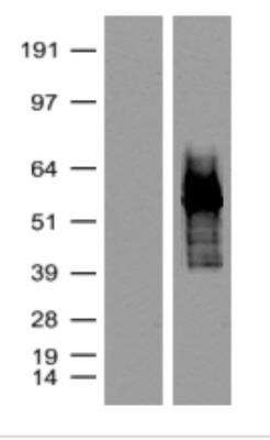 Western Blot: tdTomato Antibody (OTI2H2) [NBP2-78136]