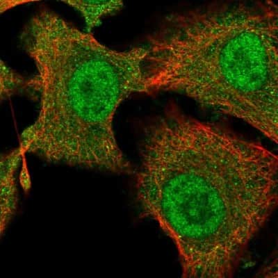 Immunocytochemistry/ Immunofluorescence: tescalcin Antibody [NBP2-13426]