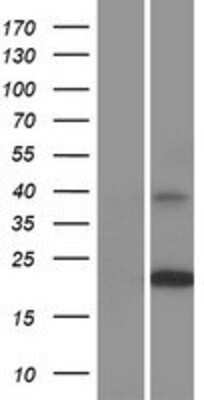 Western Blot: tetraspanin 14 Overexpression Lysate [NBP2-11120]