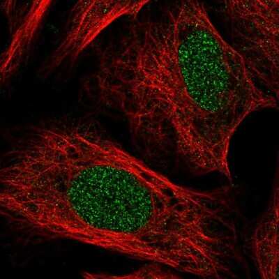 Immunocytochemistry/ Immunofluorescence: TOX Antibody [NBP2-57848]