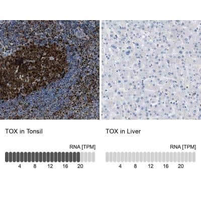 Immunohistochemistry-Paraffin: TOX Antibody [NBP1-87857]