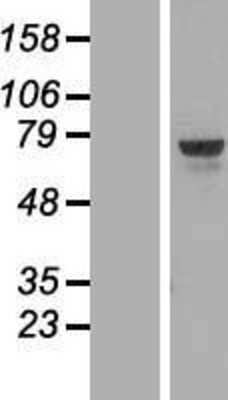 Western Blot: TOX Overexpression Lysate [NBL1-17200]