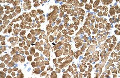 Immunohistochemistry-Paraffin: tropomyosin-2 Antibody [NBP1-57612]