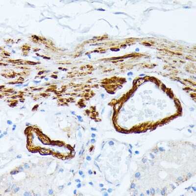 Immunohistochemistry-Paraffin: tropomyosin-2 Antibody - Azide and BSA Free [NBP2-95197]