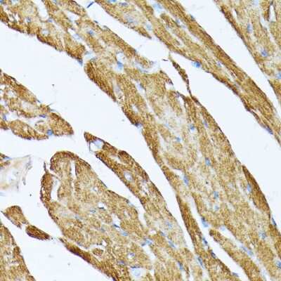 Immunohistochemistry-Paraffin: tropomyosin-2 Antibody - Azide and BSA Free [NBP2-95197]