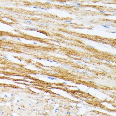 Immunohistochemistry-Paraffin: tropomyosin-2 Antibody - Azide and BSA Free [NBP2-95197]
