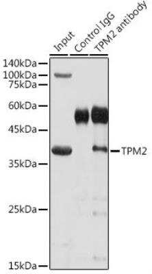 Immunoprecipitation: tropomyosin-2 Antibody - Azide and BSA Free [NBP2-95197]