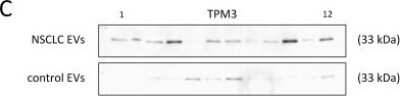 Western Blot: tropomyosin-3 Antibody (2E4) [H00007170-M02]