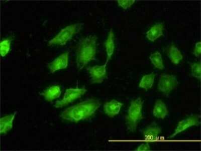 Immunocytochemistry/ Immunofluorescence: tropomyosin-4 Antibody (4E4-1D2) [H00007171-M01]