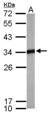 Western Blot: tropomyosin-4 Antibody [NBP2-15146]