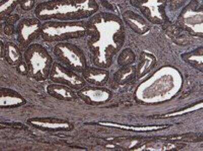 Immunohistochemistry-Paraffin: u-Plasminogen Activator/Urokinase Antibody [NB100-2419]