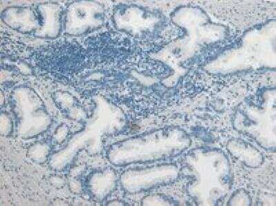 Immunohistochemistry-Paraffin: u-Plasminogen Activator/Urokinase Antibody [NB100-2419]