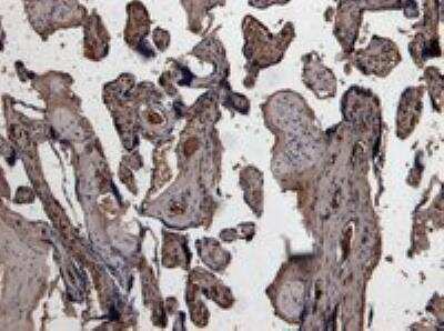 Immunohistochemistry-Paraffin: u-Plasminogen Activator/Urokinase Antibody [NB100-2419]