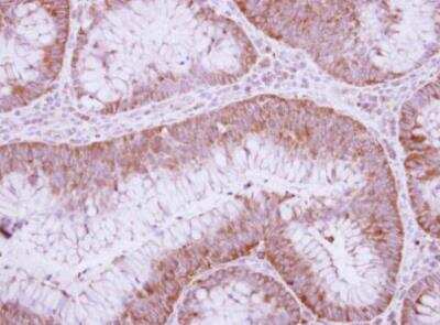 Immunohistochemistry-Paraffin: u-Plasminogen Activator/Urokinase Antibody [NBP2-20819]
