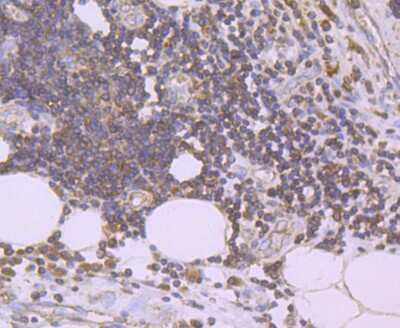 Immunohistochemistry-Paraffin: u-Plasminogen Activator/Urokinase Antibody (JM106-09) [NBP2-66766]
