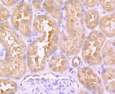 Immunohistochemistry-Paraffin: u-Plasminogen Activator/Urokinase Antibody (JM106-09) [NBP2-66766]