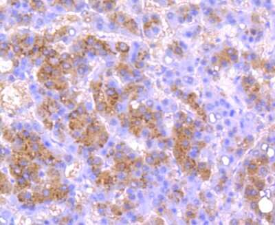 Immunohistochemistry-Paraffin: u-Plasminogen Activator/Urokinase Antibody (JM106-09) [NBP2-66766]