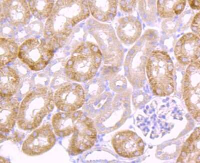 Immunohistochemistry-Paraffin: u-Plasminogen Activator/Urokinase Antibody (JM106-09) [NBP2-66766]